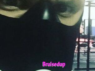 Bruisedup