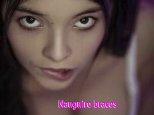 Nauguire_braces