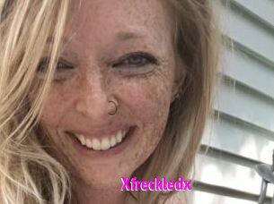 Xfreckledx